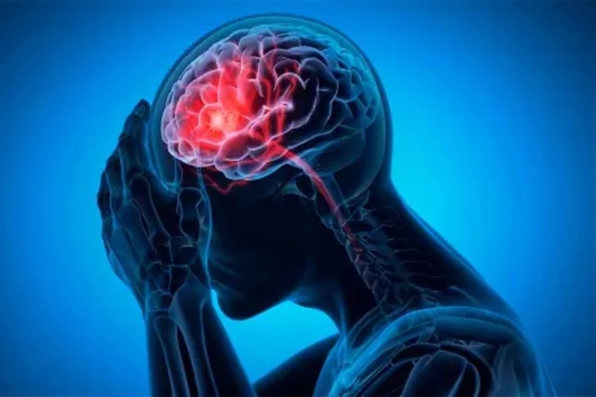 Dr. Kalakoti Chandra Sekhar Reddy | Best Neurosurgeon